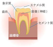 虫歯治療